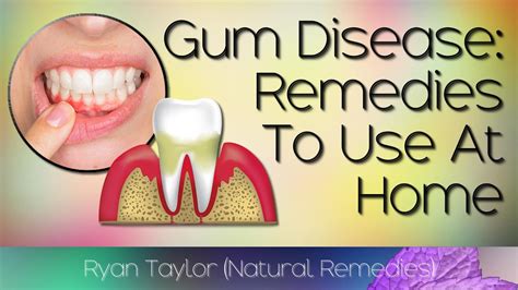How to Treat Gum Disease .